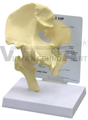 Basic Hip